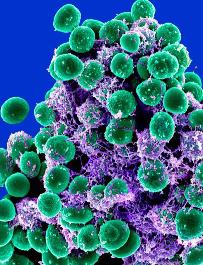 staph bacteria micrograph green purple blue